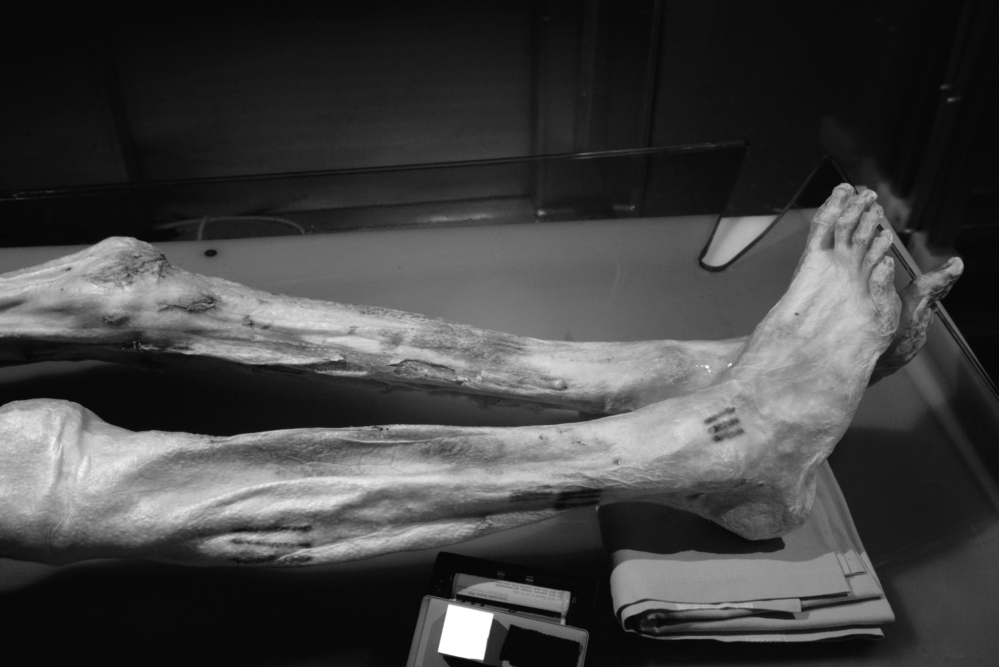 Principal Component Analysis of infrared multispectral evidence revealing Ötzi’s ankle tattoos