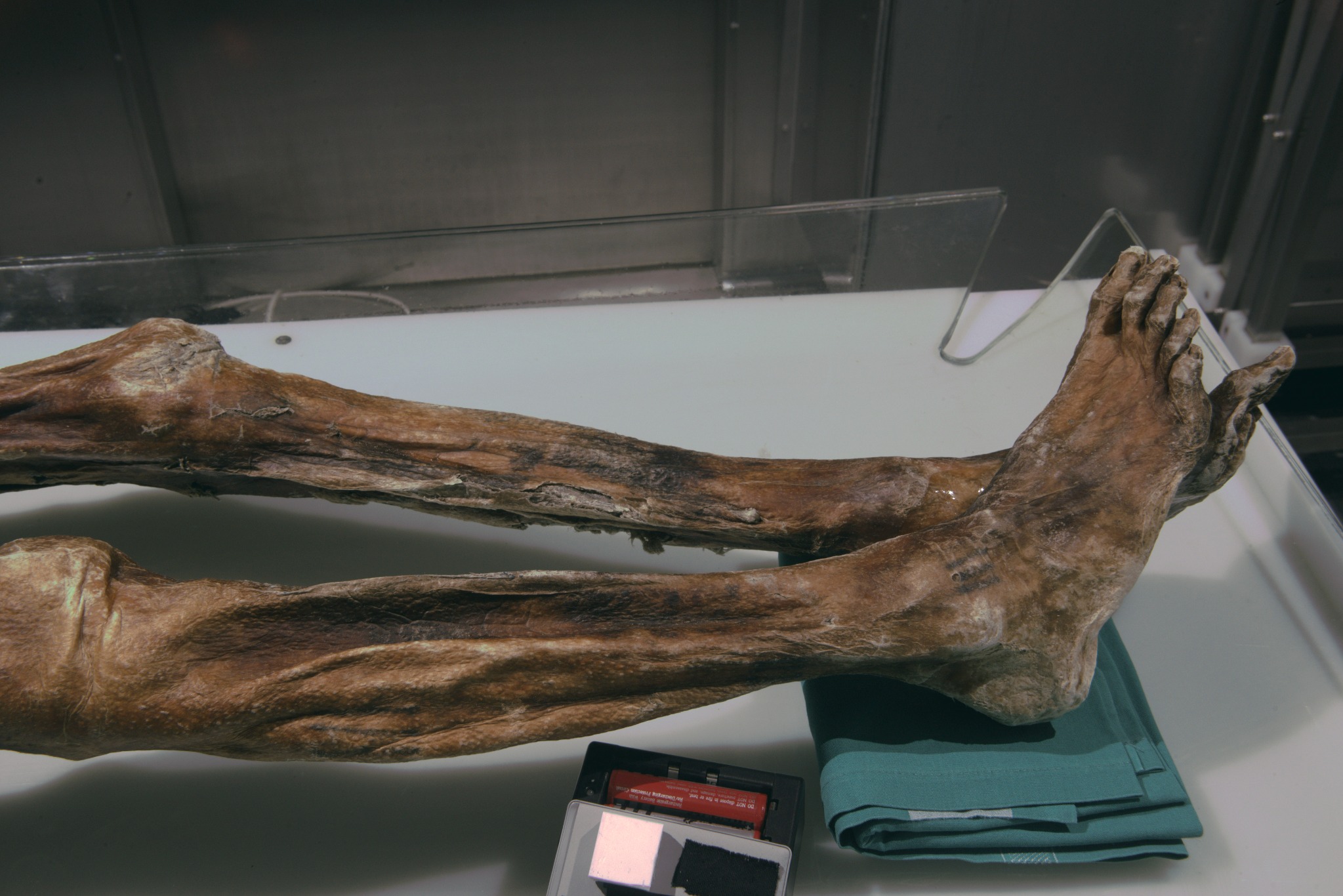 Visible-light photograph of Ötzi’s lower legs and ankle tattoos